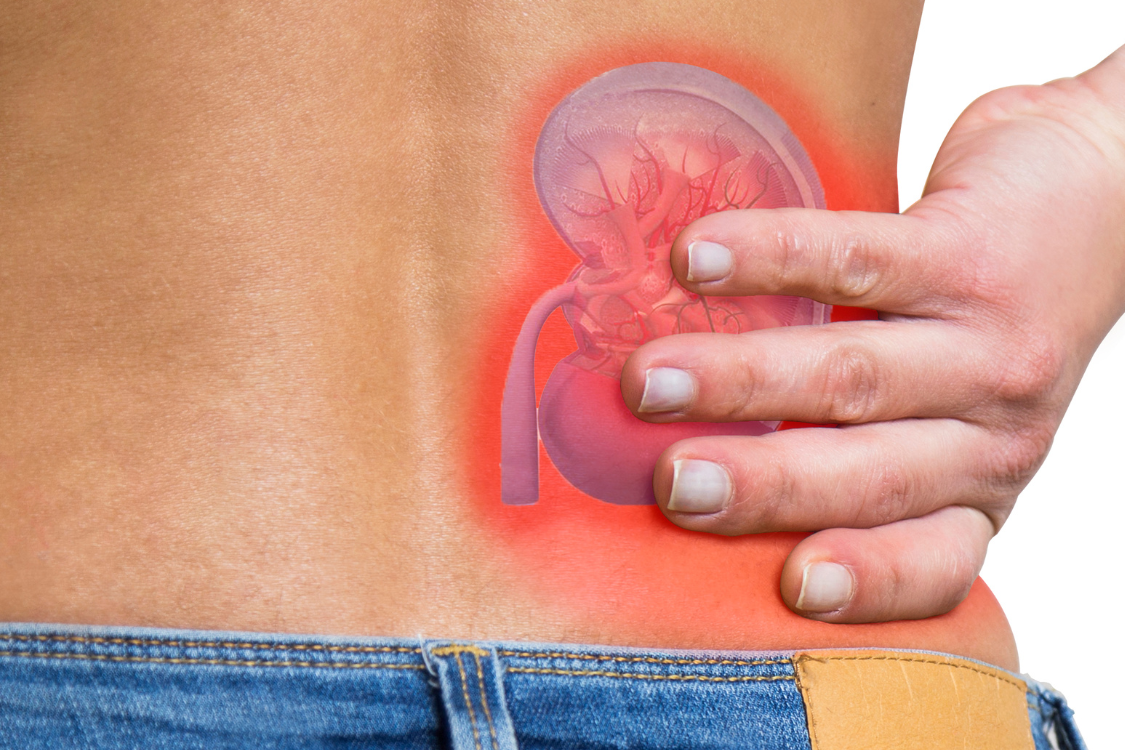 Image showing a hand resting on the lower back, highlighting the area of the kidney with a red glow, suggesting pain or potential issues related to electrolyte imbalance.